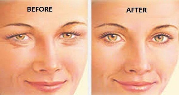 dd_201705231637_heres-how-to-tighten-loose-skin-on-the-eyelids-in-just-4-steps-.jpg
