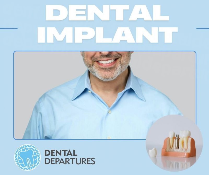 dd_202509221416_dental_implant.jpg